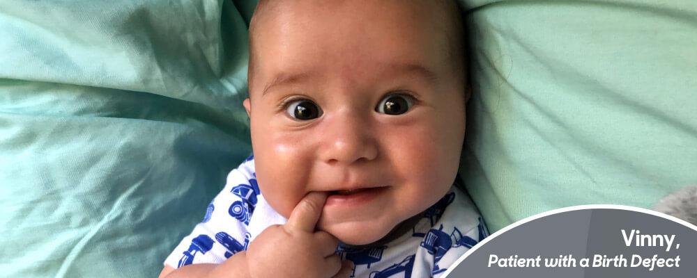 Image shows a smiling baby Vinny who is a Children's National patient with a birth defect.