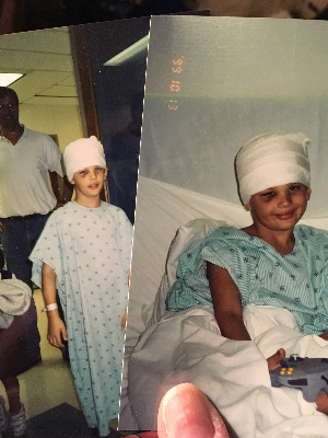 This was Nathan in October 1999, recovering from his craniotomy at Children's